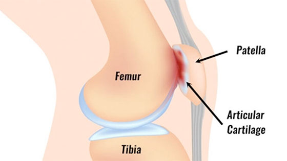 patellofemoral560 patellofemoral